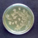 E-05a - Banana e-coli