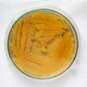 β-Carotene Yeast agar plate